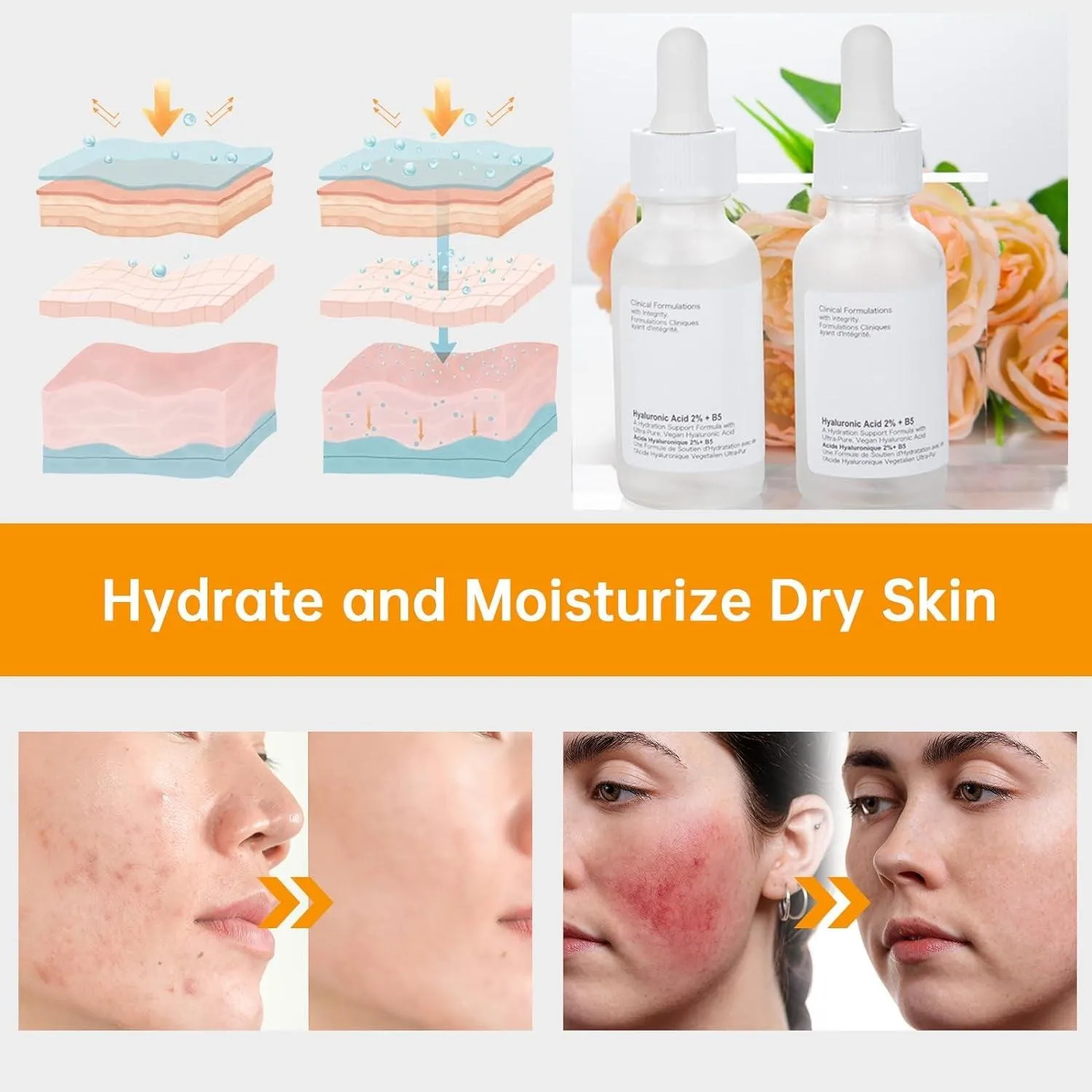 Hyaluronic Acid 2%   B5 Facial Serum, 30ML Hyaluronic Acid Serum for Face, 1 Floz Hyaluronic Acid Serum, Hyaluronic Acid and Vitamin B5, Moisturizing.